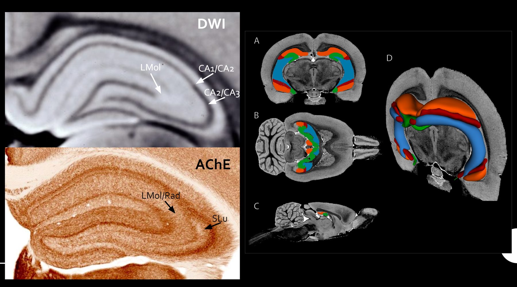 Diffusion-weighted and histochemical imaging of hippocampal subfields with segmented anatomy